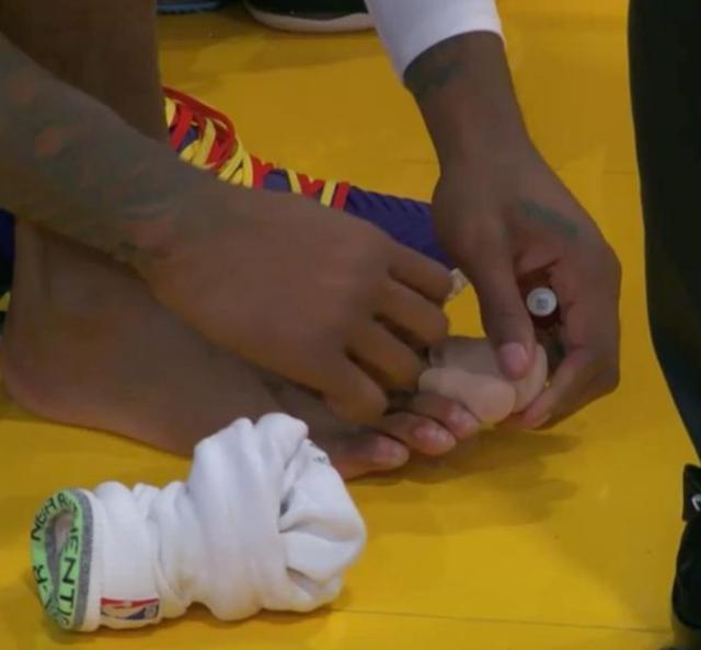 足球直播-首秀便意外伤退 德拉蒙德脚指甲脱落归期不定